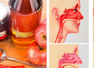 გსურთ გაიგოთ როგორ კლავს სინუსის ინფექციას რამდენიმე წუთში ვაშლის ძმარი?!