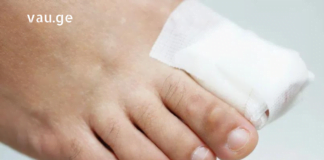 ფრჩხილის ჩაზრდა ნამდვილ სატანჯველად მექცა – ეს წამალი 83 წლის ქალბატონმა მასწავლა და შვებით ამოვისუნთქე.