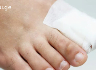 ფრჩხილის ჩაზრდა ნამდვილ სატანჯველად მექცა – ეს წამალი 83 წლის ქალბატონმა მასწავლა და შვებით ამოვისუნთქე.