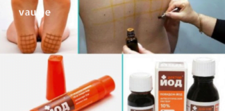 20 სხვადასხვა დაავადება, რასაც იოდის ბადეები ამსუბუქებს