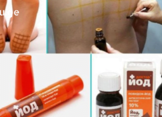 20 სხვადასხვა დაავადება, რასაც  იოდის ბადეები ამსუბუქებს