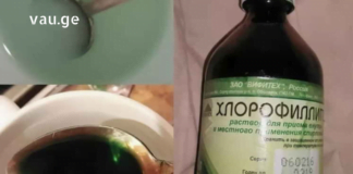 ერთ-ერთი კლინიკის ექთანმა საიდუმლოდ ჩამაწერინა გამოწეული ძვლის მოსაშორებელი საშუალება