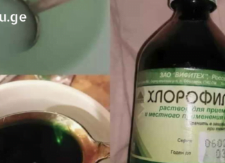 ერთ-ერთი კლინიკის ექთანმა საიდუმლოდ ჩამაწერინა გამოწეული ძვლის მოსაშორებელი საშუალება