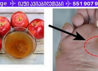 მამაჩემმა მოიშორა მეჭეჭები სამედიცინო ჩარევების გარეშე – თუ ამ დრომდე ებრძვით მეჭეჭებს აუცილებლად წაიკითხეთ ეს!