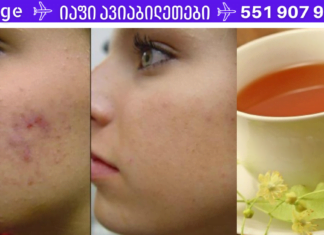 ყველა ქალბატონს უნდა ჰქონდეს ეს შესანიშნავი რეცეპტი, რომელიც დაგეხმარებათ სახის მარტივად გაწმენდაში! ნუ იჩქარებთ კოსმეტოლოგთან მისვლას, ჯერ ეს სცადეთ!