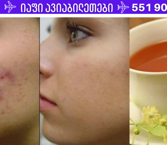 ყველა ქალბატონს უნდა ჰქონდეს ეს შესანიშნავი რეცეპტი, რომელიც დაგეხმარებათ სახის მარტივად გაწმენდაში! ნუ იჩქარებთ კოსმეტოლოგთან მისვლას, ჯერ ეს სცადეთ!