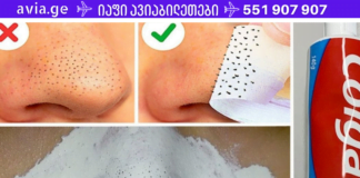 წყალი, სოდა და კბილის პასტა, ამ ნაზავით ეს გოგო დაემშვიდობა შავ ფერიმჭამელებს.