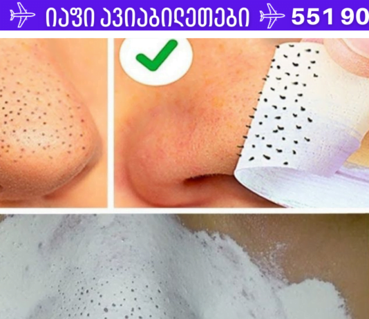 წყალი, სოდა და კბილის პასტა, ამ ნაზავით ეს გოგო დაემშვიდობა შავ ფერიმჭამელებს.