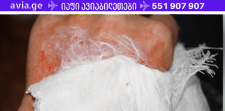 ხალხური მედიცინის უძველესი საიდუმლოებები: ობობის ქსელის სამკურნალო თვისებები, რომელსაც ყველაზე მძიმე ჭრილობების მორჩენაც კი შეუძლია!