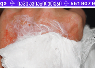 ხალხური მედიცინის უძველესი საიდუმლოებები: ობობის ქსელის სამკურნალო თვისებები, რომელსაც ყველაზე მძიმე ჭრილობების მორჩენაც კი შეუძლია!