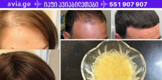 ამ 3 ინგრედიენტის მარტივი ნაზავი დაგეხმარებათ თქვენი თმის ჯანმრთელი ზრდის სტიმულირებაში.