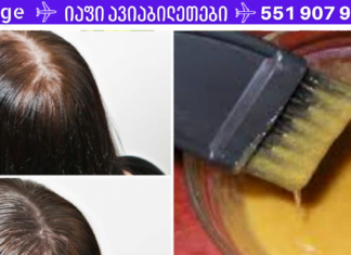 მდოგვი შაქრით სასწაულებს ახდენს! არ მეგონა ამ ნარევის ეფექტი ასეთი შესამჩნევი თუ იქნებოდა!