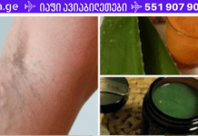 ვარიკოზი არ არის განაჩენი! 2 ძველი რეცეპტი შემონახული ხალხური მედიცინისგან, რომელთა ეფექტურობაში მე და ჩემი მეუღლე უკვე დავრწმუნდით!