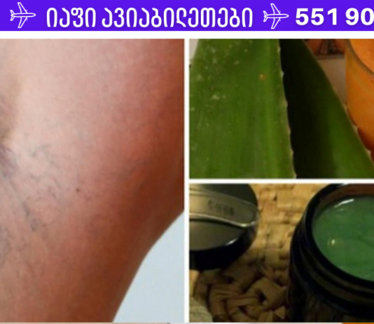 ვარიკოზი არ არის განაჩენი! 2 ძველი რეცეპტი შემონახული ხალხური მედიცინისგან, რომელთა ეფექტურობაში მე და ჩემი მეუღლე უკვე დავრწმუნდით!