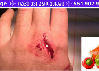 როგორ შევაჩეროთ სისხლდენა სულ რაღაც 5 წამში? დაგეხმარებათ სანელებელი, რომელიც ყველას გაქვთ სამზარეულოში!