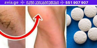 თუ ქუსლები ქრონიკულად გისკდებათ, გამოიყენეთ ეს საშუალება! დედაჩემს ეს რეცეპტი მეგობარმა ურჩია, რომელიც კოსმეტოლოგად მუშაობდა მოსკოვში 70-იან წლებში!