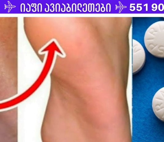 თუ ქუსლები ქრონიკულად გისკდებათ, გამოიყენეთ ეს საშუალება! დედაჩემს ეს რეცეპტი მეგობარმა ურჩია, რომელიც კოსმეტოლოგად მუშაობდა მოსკოვში 70-იან წლებში!