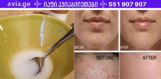 მას შემდეგ რაც სახეს ამ ნარევით დაიბანთ, სამუდამოდ დაემშვიდობეთ მუწუკებსა და ნაოჭებს!