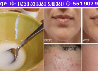 მას შემდეგ რაც სახეს ამ ნარევით დაიბანთ, სამუდამოდ დაემშვიდობეთ მუწუკებსა და ნაოჭებს!