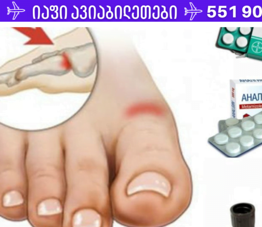სახსრის გასიების დროს, თუ ტკივილები გაწუხებთ, შვებას იგრძნობთ ამ კომპრესის გაკეთებით.