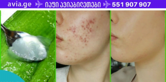 სწრაფად და ეფექტურად მოვიცილე აკნე, დამიმშვიდდა კანი -ეს ბუნებრივი ანტისეპტიკია!