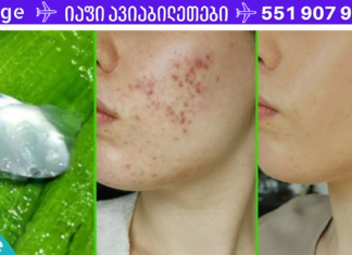 სწრაფად და ეფექტურად მოვიცილე აკნე, დამიმშვიდდა კანი -ეს ბუნებრივი ანტისეპტიკია!