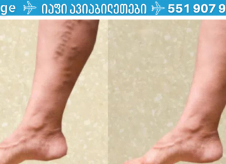 ჯადოსნური 2-კომპონენტიანი რეცეპტი თრომბოზისა და ვარიკოზული ვენებისთვის. ეს უნდა სცადოთ!