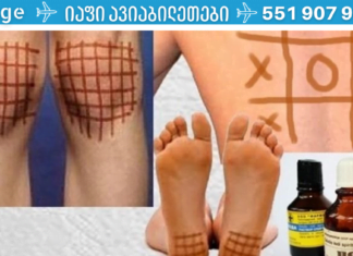 თქვენ შეგიძლიათ დათვალოთ მინიმუმ 20 დაავადება, რასაც იოდის ბადეები ამსუბუქებს!