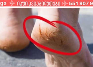 აი რა უნდა მოიმოქმედოთ როცა დაქეთხილი ქუსლები გტანჯავთ.. ამ ძლიერი სამკურნალო რეცეპტის შესახებ უნდა იცოდეთ!