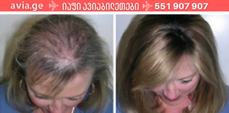 დღეს შემოგთავაზებთ ნიღბის რეცეპტს, რომელიც თავისი ეფექტურობით ადვილად გაუწევს კონკურენციას ბევრ ძვირადღირებულ პროდუქტს.