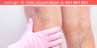 ვარიკოზული ვენების ხალხური მალამო, რომელმაც მამაჩემი ოპერაციას გადაარჩინა! ექიმები გაოცებული დარჩნენ!