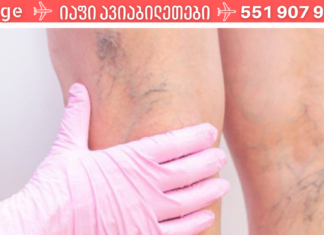 ვარიკოზული ვენების ხალხური მალამო, რომელმაც მამაჩემი ოპერაციას გადაარჩინა! ექიმები გაოცებული დარჩნენ!