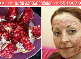 როგორც კი პირველი ნაოჭი შევამჩნიე სახეზე, მაშინვე ბროწეულის ნიღაბის წასმა დავიწყე და დღემდე ამით ვაჩერებ დაბერების პროცესს!