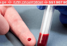 გაინტერესებთ, როგორ აიცილოთ თავიდან სისხლის შედედებით გამოწვეული ფარული საფრთხეები? გამოსავალს სტატიაში ამოიკითხავთ!