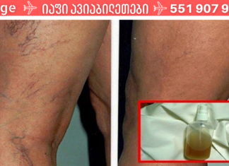 ბუნებრივი ინგრედიენტებისგან დამზადებული ეს ბალზამი საუკეთესო საშუალებაა სისხლძარღვთა “ქსელის” მოსაშორებლად და კანის სილამაზის აღსადგენად!