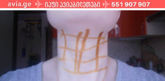 იოდის ბადე – მარტივი ხაზების სამკურნალო თვისებები! ამის ცოდნა ყველას გამოგადგებათ!