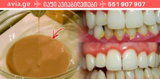 თუ ჩემსავით თქვენც ნერვიულობთ გაყვითლებულ და ქვებით სავსე კბილებზე, გამოივლეთ პირის ღრუში ეს საშალება და შედეგი გაგაოცებთ!
