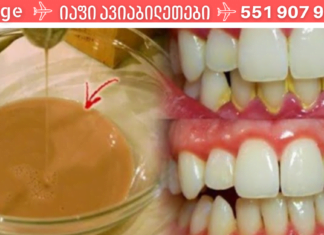 თუ ჩემსავით თქვენც ნერვიულობთ გაყვითლებულ და ქვებით სავსე კბილებზე, გამოივლეთ პირის ღრუში ეს საშალება და შედეგი გაგაოცებთ!