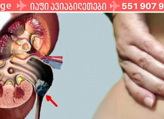 თუ თირკმელებში კენჭები გაქვთ მიმართეთ ამ მეთოდს! სასწაული შედეგი აქვს!