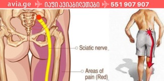 ნუ დახარჯავთ ძვირადღირებულ წამლებზე ფულს. აი როგორ სწრაფად შეგვიძლია გავათავისუფლოთ მწვავე ტკივილი სახლის პირობებში!