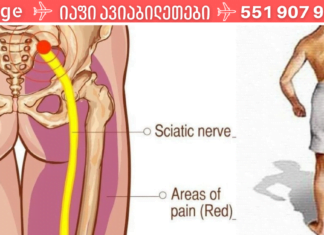 ნუ დახარჯავთ ძვირადღირებულ წამლებზე ფულს. აი როგორ სწრაფად შეგვიძლია გავათავისუფლოთ მწვავე ტკივილი სახლის პირობებში!