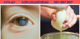 უმკურნალეთ კატარაქტას ხალხური, მეტად ეფექტური საშუალებით! მე მხოლოდ ამან მიშველა!