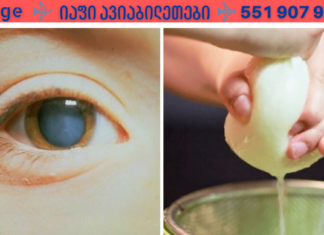 უმკურნალეთ კატარაქტას ხალხური, მეტად ეფექტური საშუალებით! მე მხოლოდ ამან მიშველა!