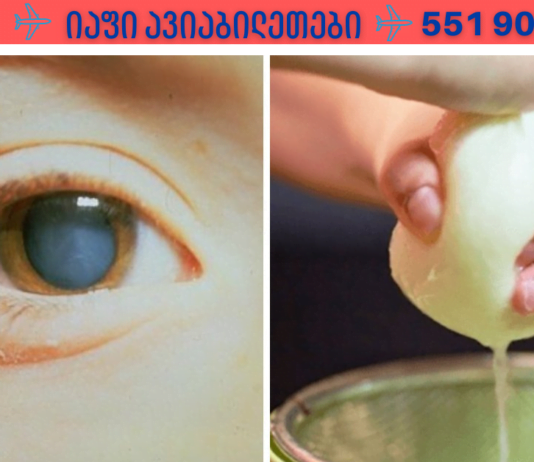 უმკურნალეთ კატარაქტას ხალხური, მეტად ეფექტური საშუალებით! მე მხოლოდ ამან მიშველა!