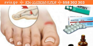 იოდის და ასპირინის ნარევი გაგათავისუფლებთ ძვლების ტკივილისგან! ეს რეცეპტი სასწაულია!