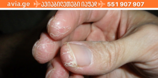 შეაჩერეთ კანის დახეთქვა დროულად! ამ ყველაფრისთვის საჭირო კი მხოლოდ ეს საშუალებაა!