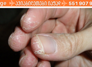 შეაჩერეთ კანის დახეთქვა დროულად! ამ ყველაფრისთვის საჭირო კი მხოლოდ ეს საშუალებაა!