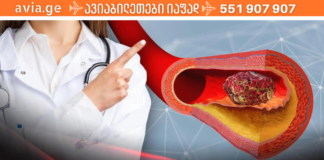 რომელი საკვები ათხელებს სისხლს? ეს პროდუქტები ხსნის ჩაკეტილ თრომბებს!