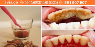 კბილების გათეთრება 2 წუთში! ამ რეცეპტის წინაშე სტომატოლოგებიც უძლურნი არიან!