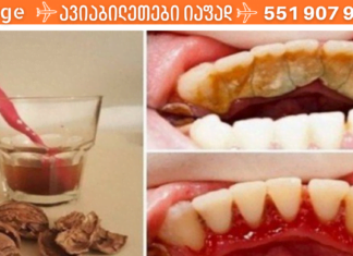 კბილების გათეთრება 2 წუთში! ამ რეცეპტის წინაშე სტომატოლოგებიც უძლურნი არიან!